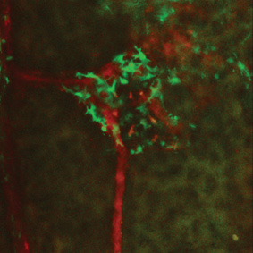 צילום במיקרוסקופ דו-פוטוני של תאים דנדריטיים (בירוק) וכלי דם (באדום) בלשד העצם של גולגולת עכבר